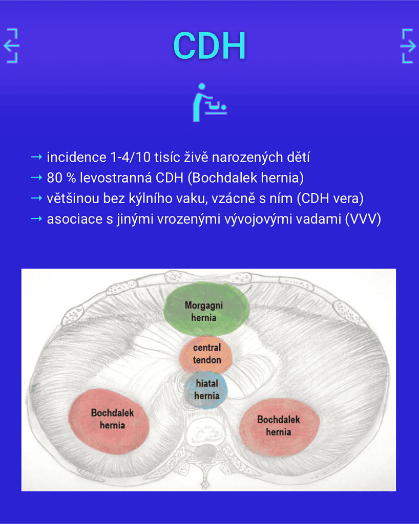 Nadační Fond NICU ÚPMD – CDH 4