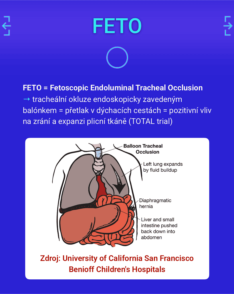 Nadační Fond NICU ÚPMD – CDH 7