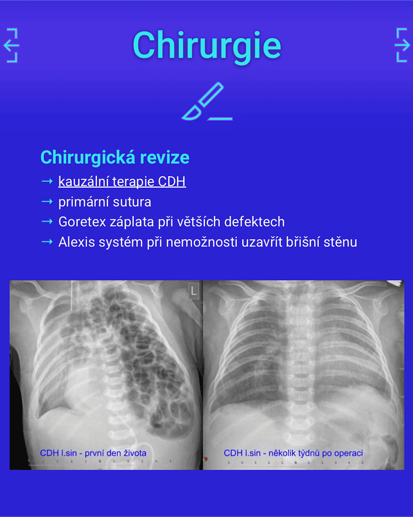 Nadační Fond NICU ÚPMD – CDH 9