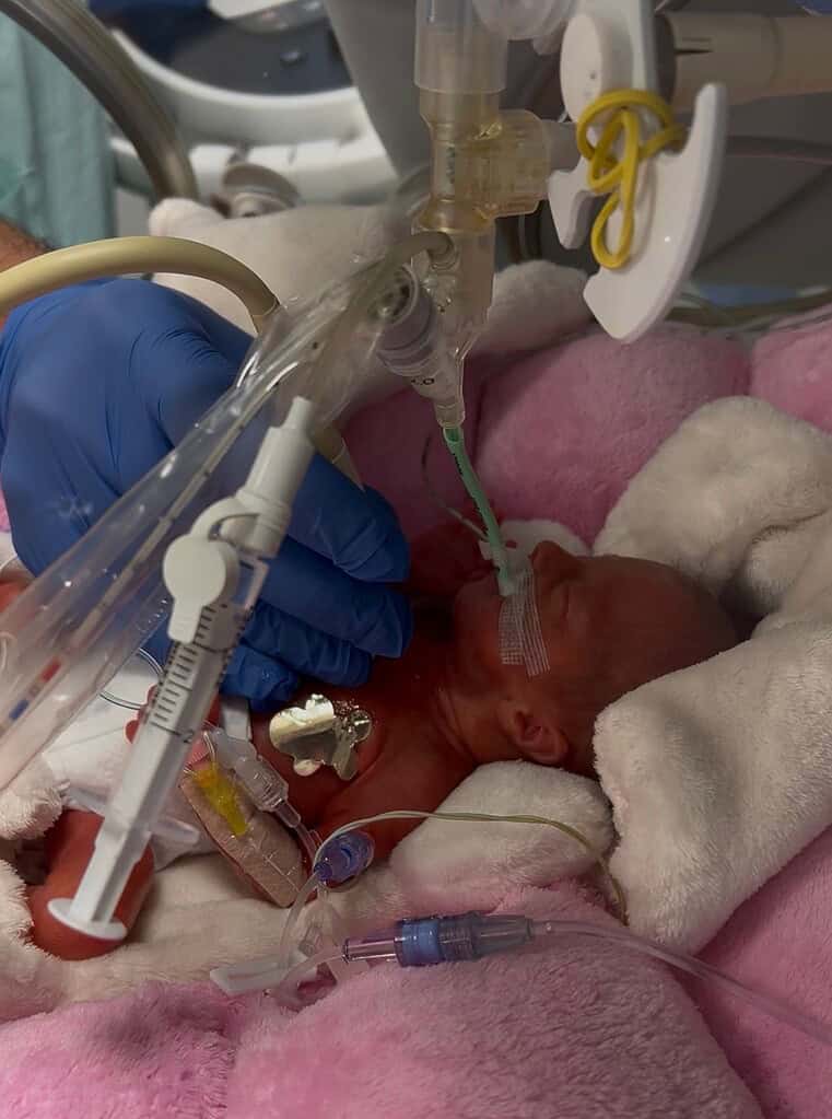 NF_NICU_ECHO