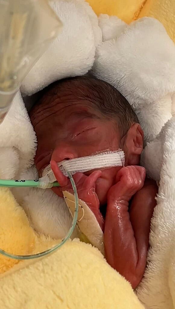 NF_NICU_Novorozenec_2