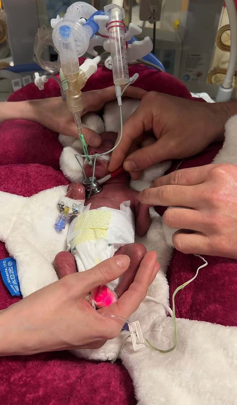 NF_NICU_Prematurita