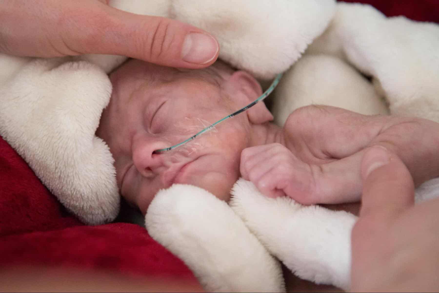 Nadační Fond NICU ÚPMD