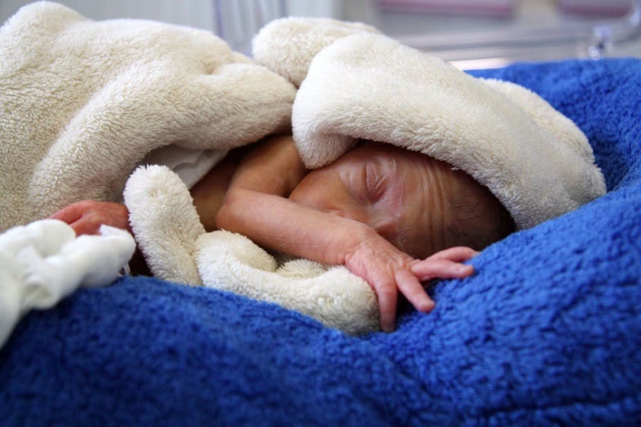 Nadační Fond NICU ÚPMD – NF NICU Pelisek